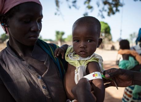 A doctor from the Alliance Médicale Contre le Paludisme (AMCP, the Medical Alliance against Malaria) uses an armband to measure the mid-upper arm circumference of a small child while a woman holds her. 
