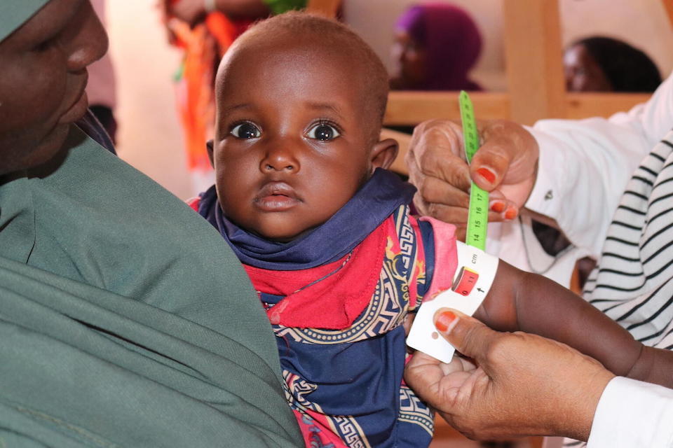 A child is screened for malnutrition at the Kalkaal Health Center in Burtinle town, Nugal region, Somalia, where UNICEF works with local partners to provide health and nutrition services to children and women in need.